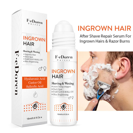Conveniently Apply Roller Hair In-growth For Men