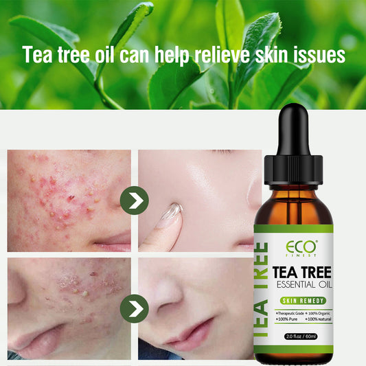 Essential Tea Tree Oil Massage Essential Oil Acne Fade