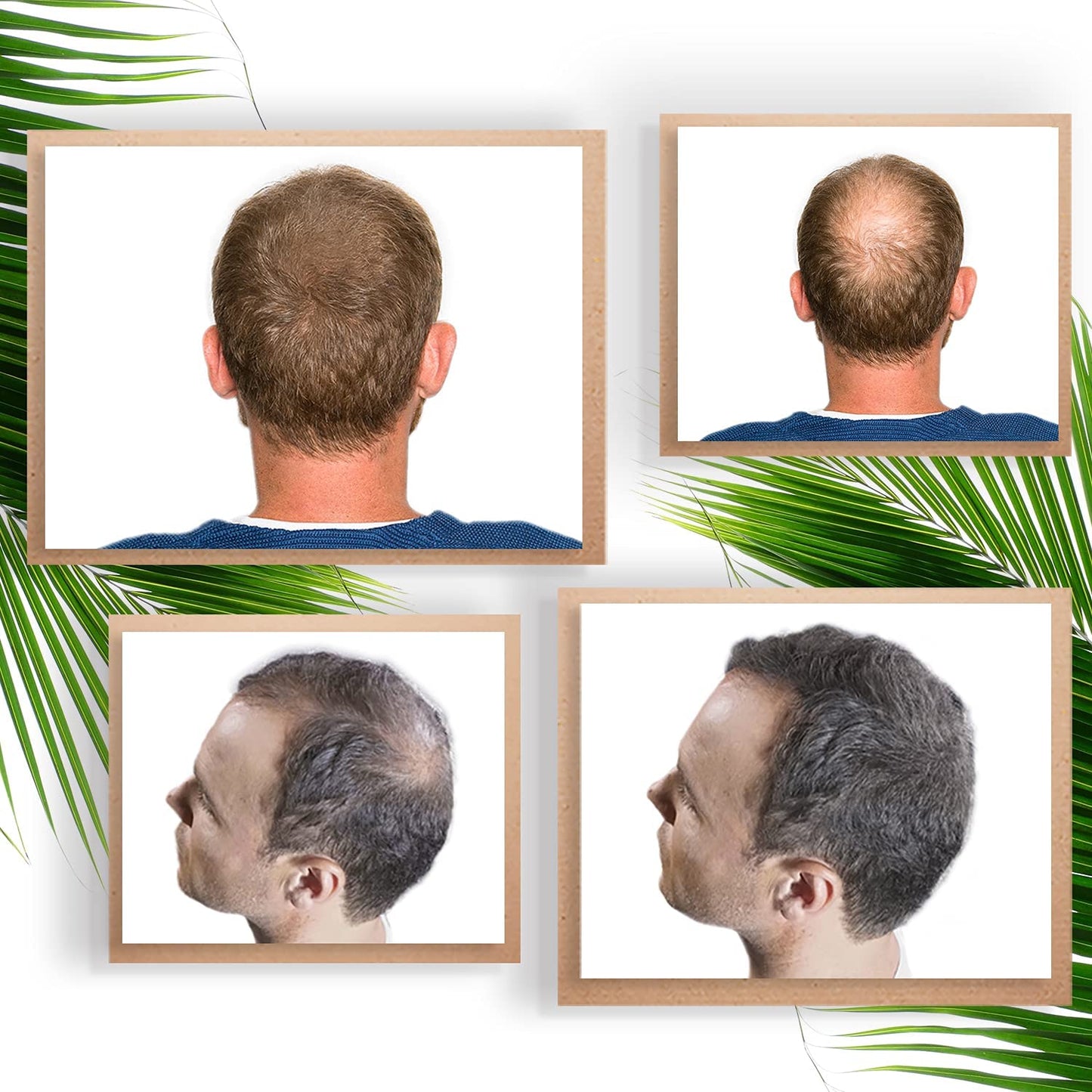 Aplicador Fibras Capilares I Atomizador Fibras Capilares I Aplicador Para El Densificador De Cabello Vidaforce I Atomizador De Fibras Capilares Amazon I Difusor Fibras Capilares