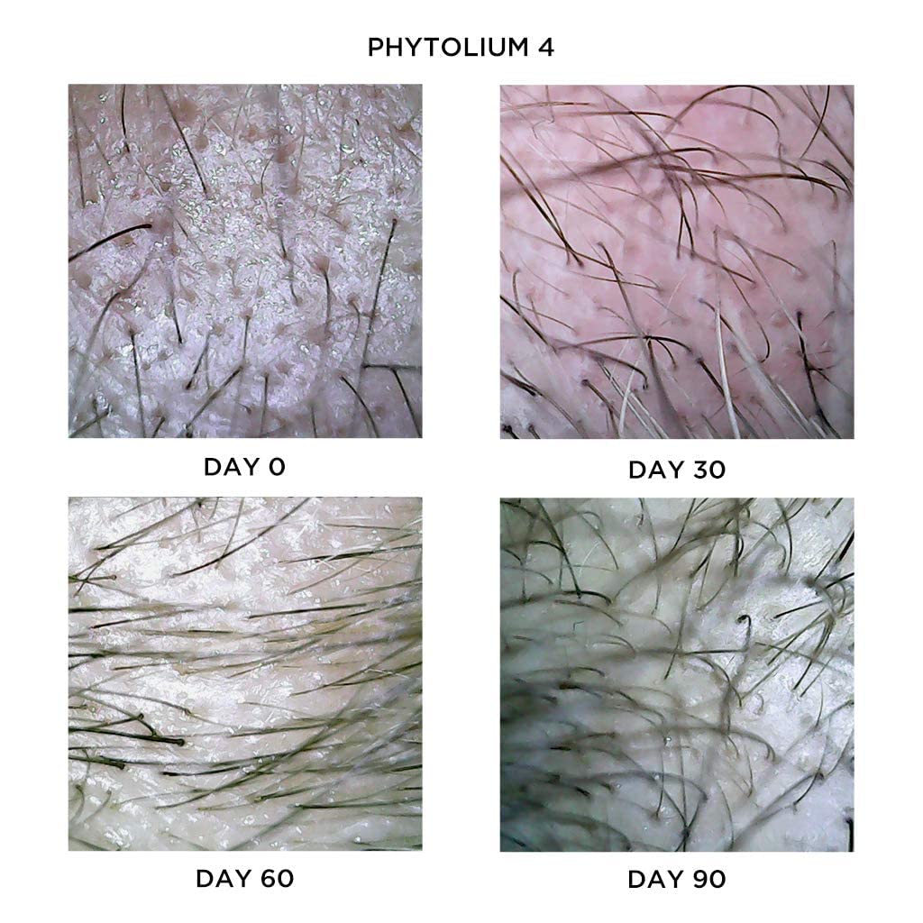 PHYTO PHYTOLIUM4 ampuller mot håravfall män 12 x 3,5 ml