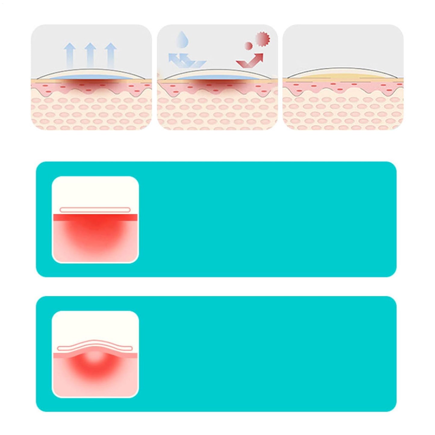 Hydrocolloid Bandages Wound Care - Flexible Moist Healing Patch Roll, Hydrocolloid Roll, Cut-to-size Waterproof Wound Cover, Home Moist Patch Flexible Breathable For Toe Face Pimple Cuts- 1.96inx9.8ft
