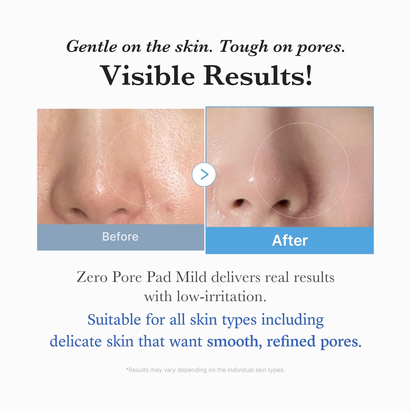 MEDICUBE Zero Pore Pad Mild 70 Pcs (155 g)