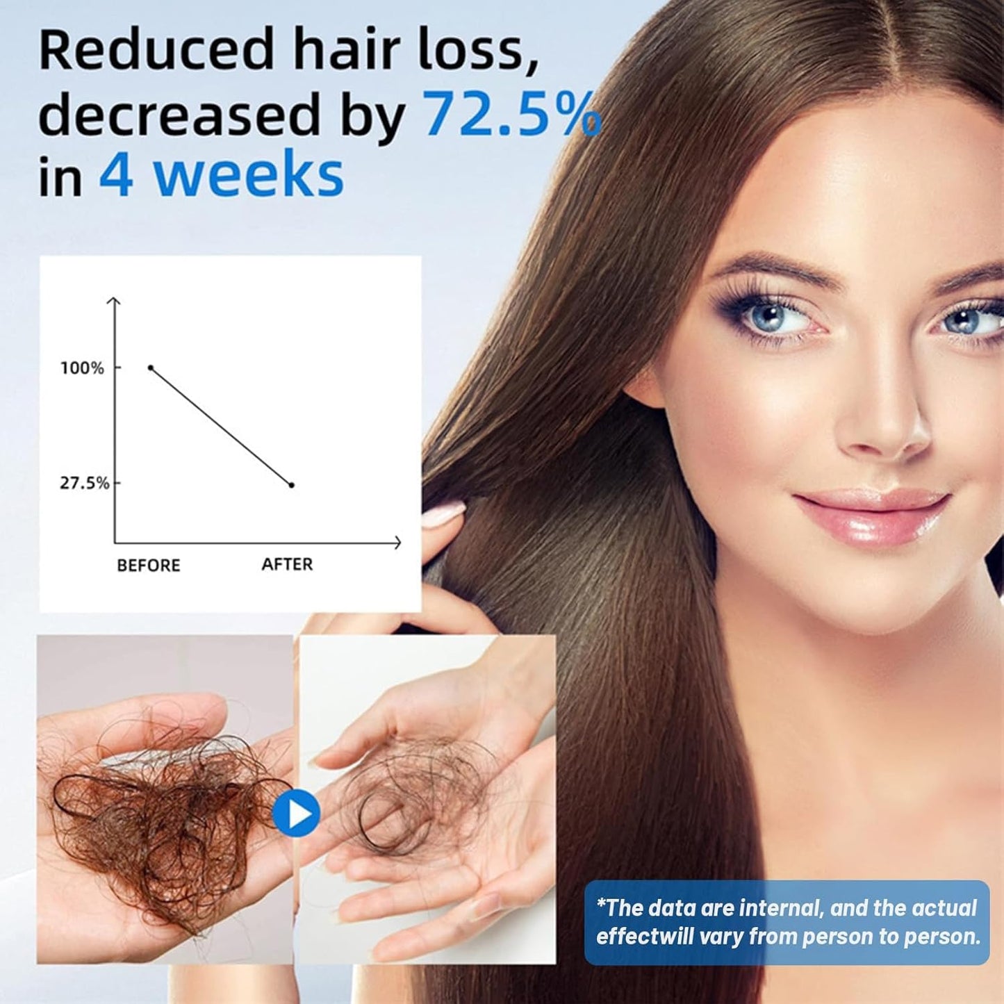 Rosemary Scalpy Hair Growth Serum Roll On 25 Ml, Orrenaturals Hair Revival Ampull, Riktad HåRlinje Och StöD FöR Tunt HåR, LäTt,1pcs