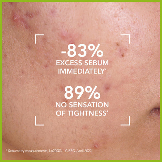 Sébium Gel Moussant - Limpiador Purificante Suave - Elimina El Exceso De Sebo Y Las Impurezas - Pieles Mixtas a Grasas - Prescrito Por Dermatólogos - Envase Con Dosificador De 500 Ml