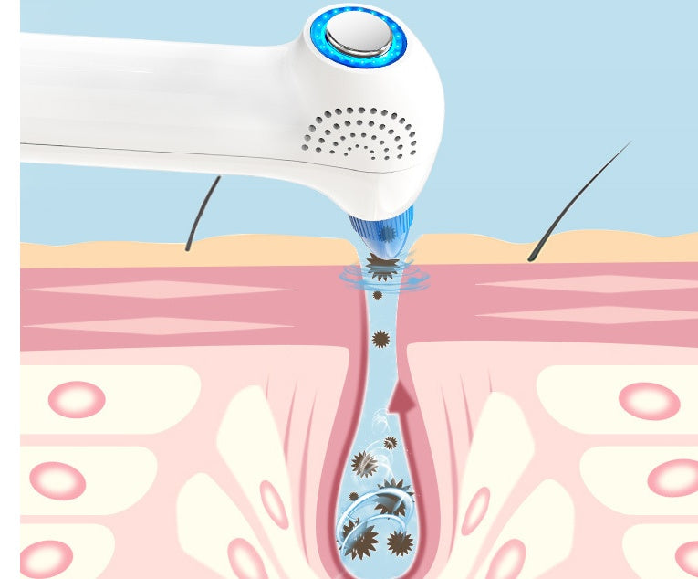 Electric Blackhead Instrument Cold And Hot Application Color Light Absorption