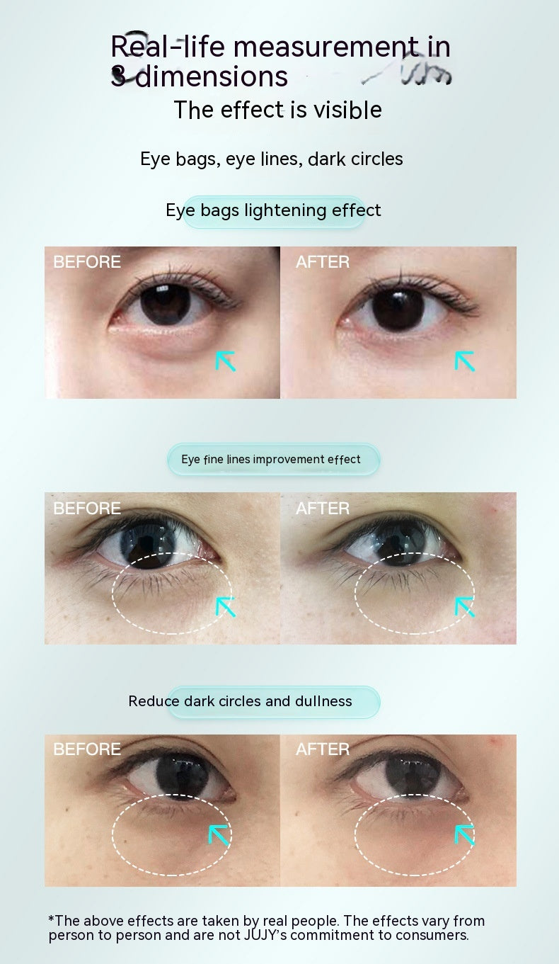 Eye Beauty Device With Delicate And Radiant Colored Light Around The Eyes