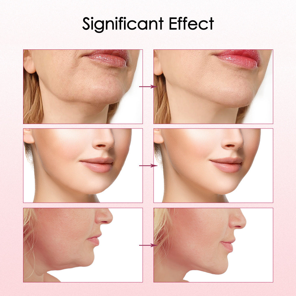 V15 Gear Heating Model Facial Lifting And Tightening Double Chin Micro Current Face Slimming Device