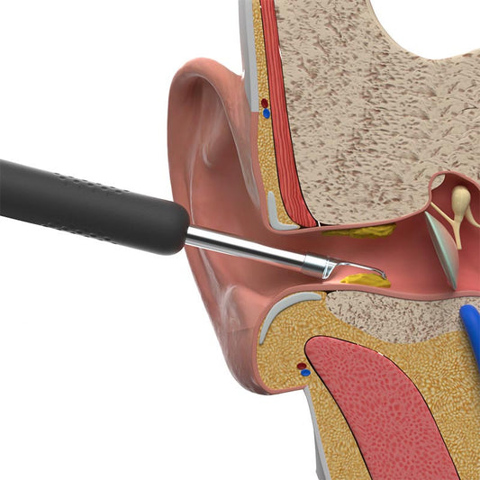 Visual Wireless Smart High-Definition Ear Picker