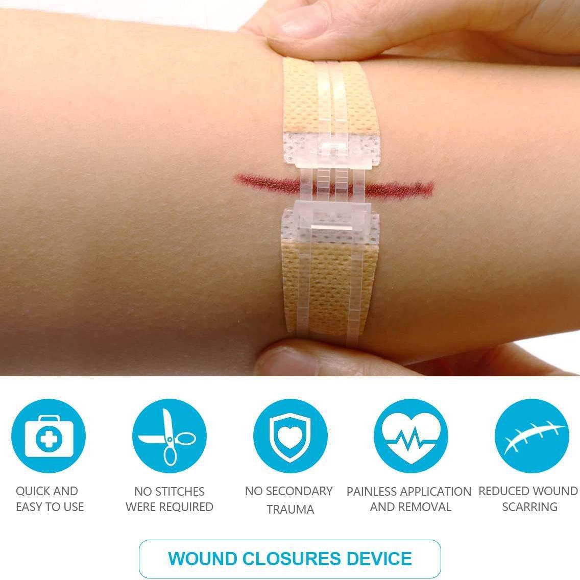 Non-woven Zipper Skin Stapler Wound Suture Patch Pull Self-adhesive Bandage