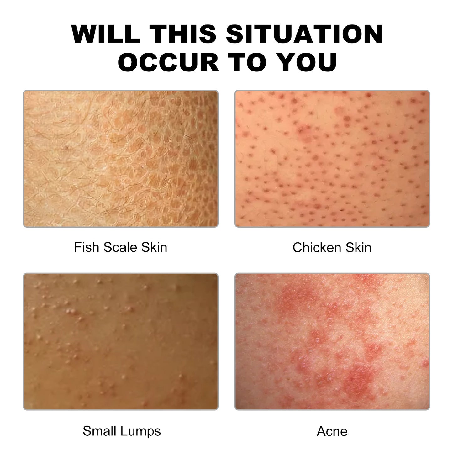 Deep Cleansing Smooth Cream Cleansing Skin Acne Cutin Dredging Pores Hydrating