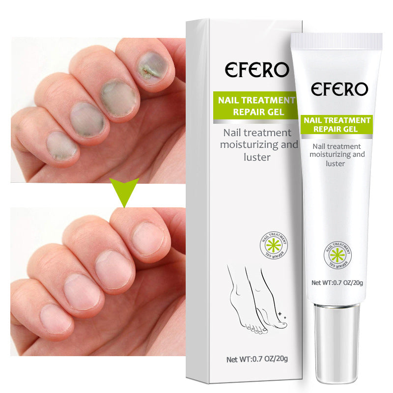 Nail Gel Nail Liquid Plant Nail Liquid