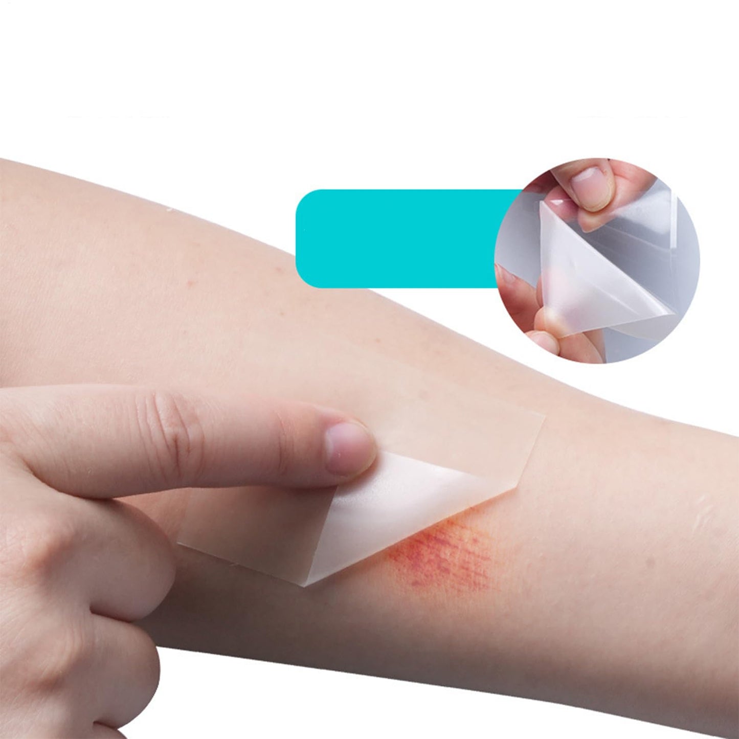 Hydrocolloid Bandages Wound Care - Flexible Moist Healing Patch Roll, Hydrocolloid Roll, Cut-to-size Waterproof Wound Cover, Home Moist Patch Flexible Breathable For Toe Face Pimple Cuts- 1.96inx9.8ft