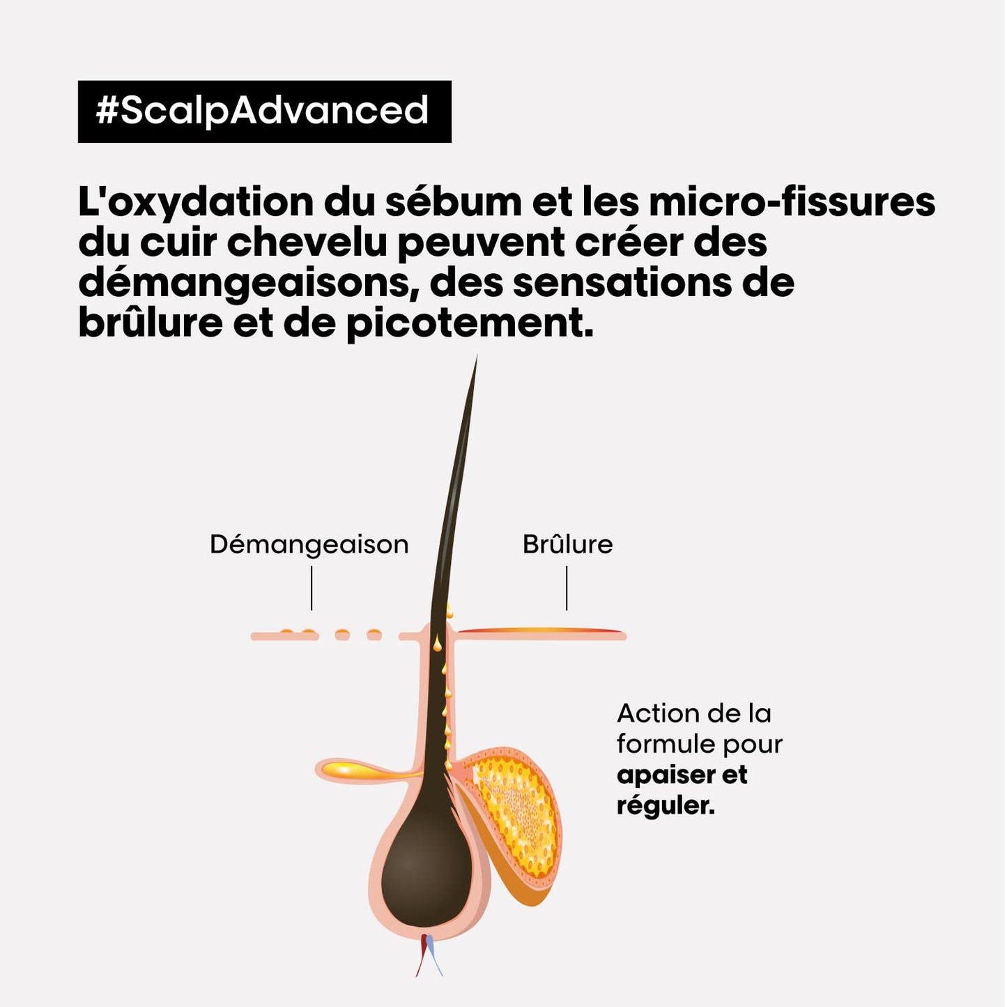 L'Oréal Professionnel Vårdbehandling för att lugna känslig hårbotten, Scalp Advanced, Anti-Discomfort Intense Soother Behandling, 200 ml