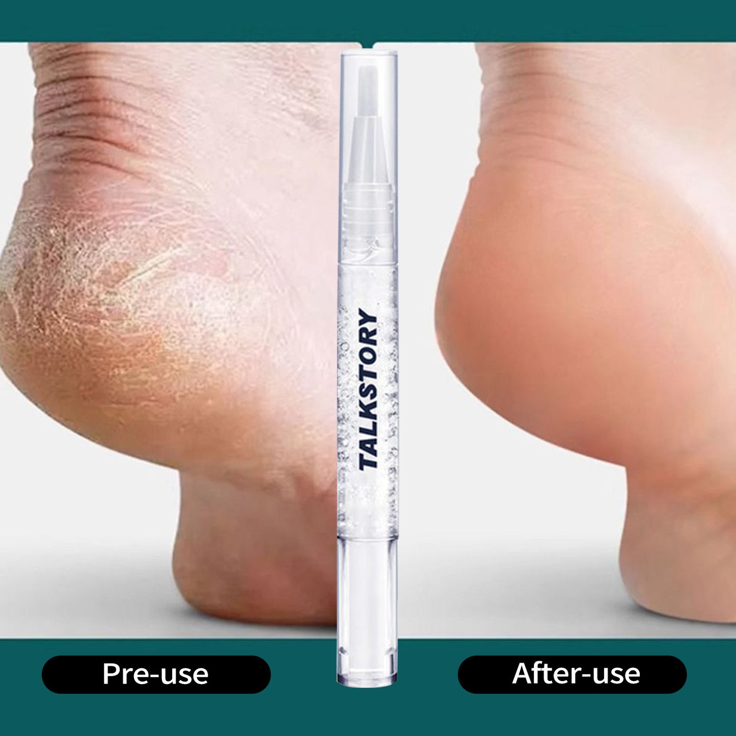 Nail Nutrition Oil Pen Exfoliating Skin Anti-agnail Manicure Implement