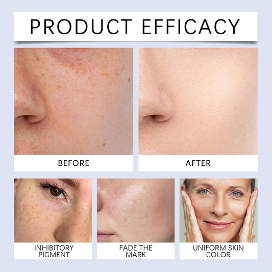 Svartvitt är exfolierande för ansikte och kropp, innovativ peel shot-teknik och fuktgivande porminimiserare, formulerad för alla hudtyper med niacinamid och hyaluronserum (Svart & Vitt)