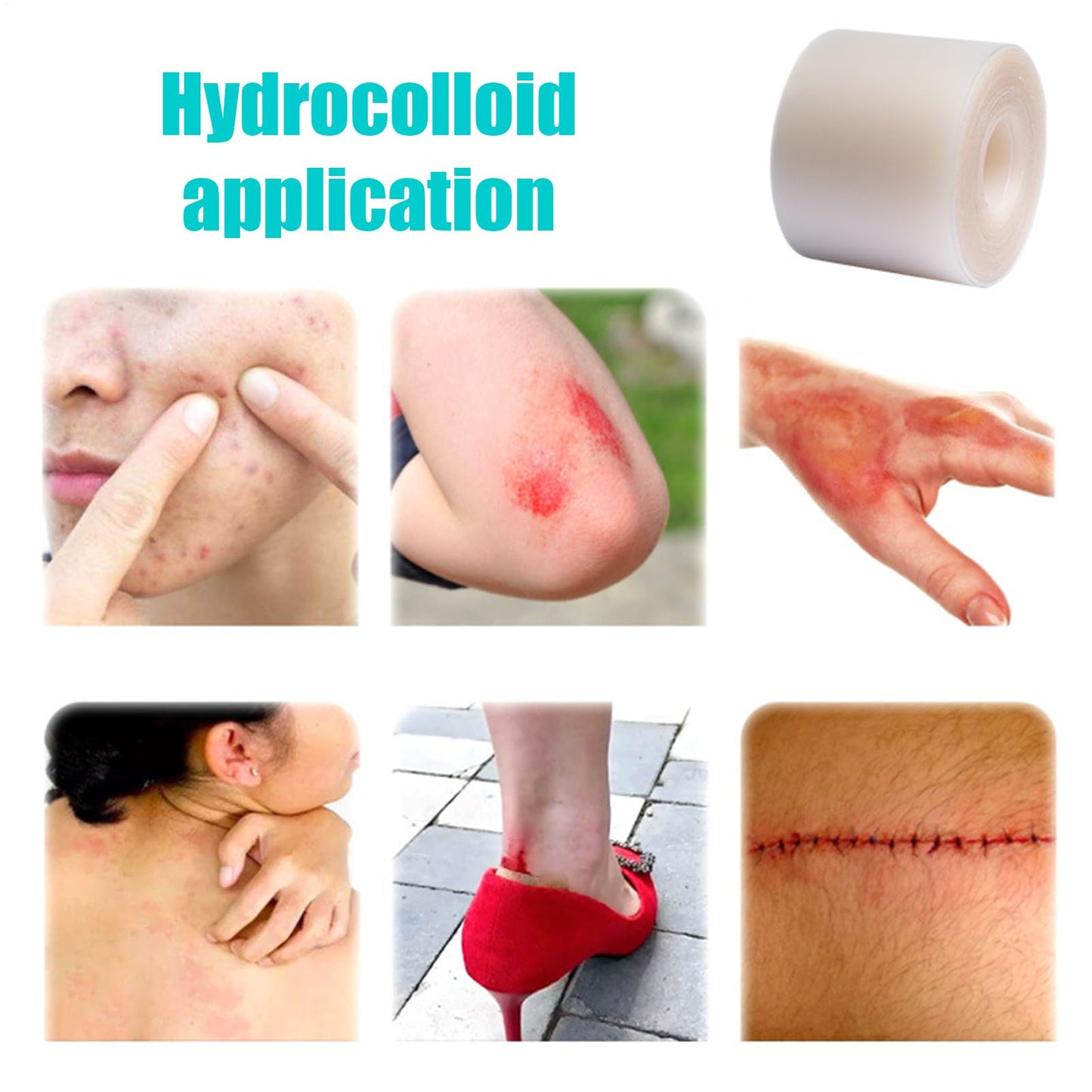 Hydrocolloid Bandages Wound Care - Flexible Moist Healing Patch Roll, Hydrocolloid Roll, Cut-to-size Waterproof Wound Cover, Home Moist Patch Flexible Breathable For Toe Face Pimple Cuts- 1.96inx9.8ft
