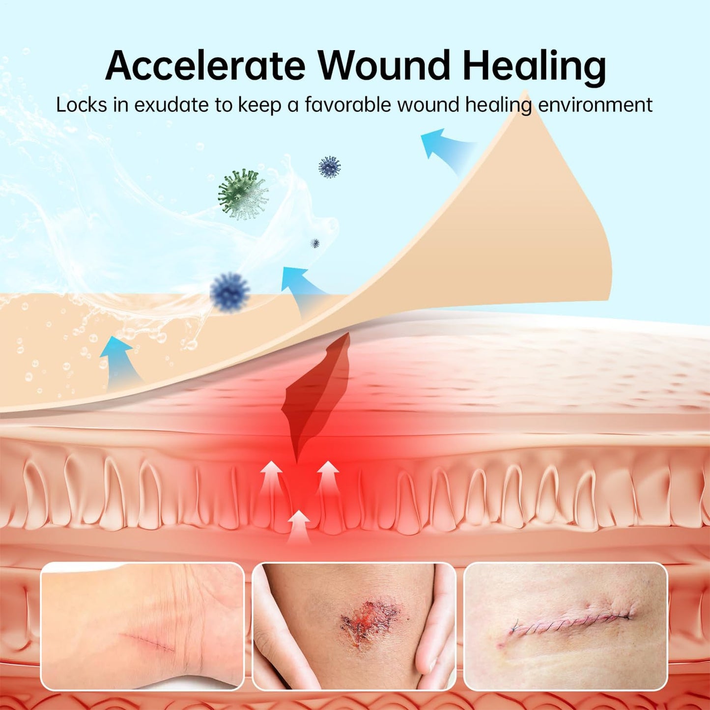Hydrocolloid Bandages Wound Care - Flexible Moist Healing Patch Roll, Hydrocolloid Roll, Cut-to-size Waterproof Wound Cover, Home Moist Patch Flexible Breathable For Toe Face Pimple Cuts- 1.96inx9.8ft