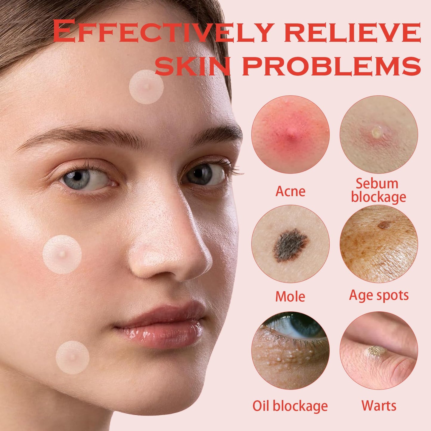 SHUOHONG 144 stycken Acne Patch Hydrokolloid Acne Patches Korn, Pimple Teolja Patches, osynliga fläckar, ansiktsbehandling, lämplig för alla hudtyper