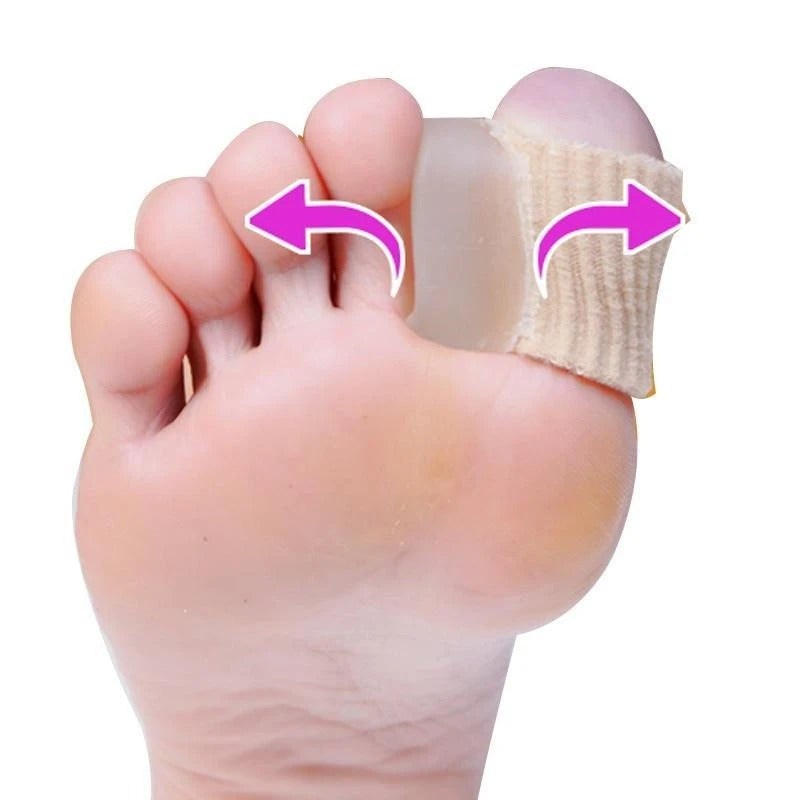 Hallux valgus orthosis