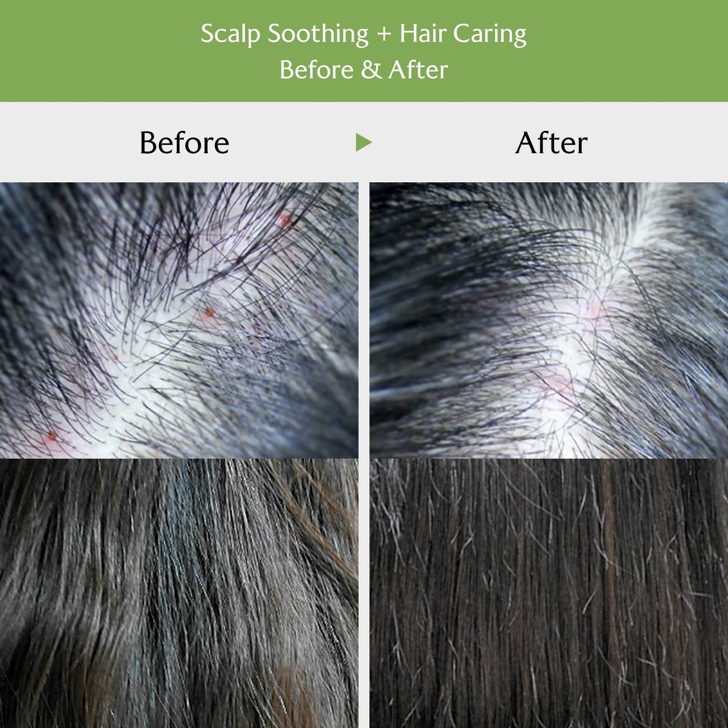 LA'DOR Tea Tree Scalp Clinic Hair Pack 200 ml – kylande uppfriskande hårbottenhår tea tree snigelslime grönt te extrakt hårbottenbehandling lindrar torr hårbotten böjer mjäll