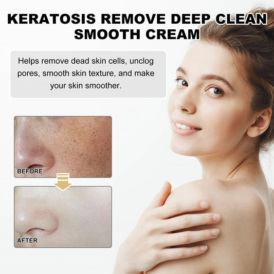 Deep Cleansing Smooth Cream Cleansing Skin Acne Cutin Dredging Pores Hydrating