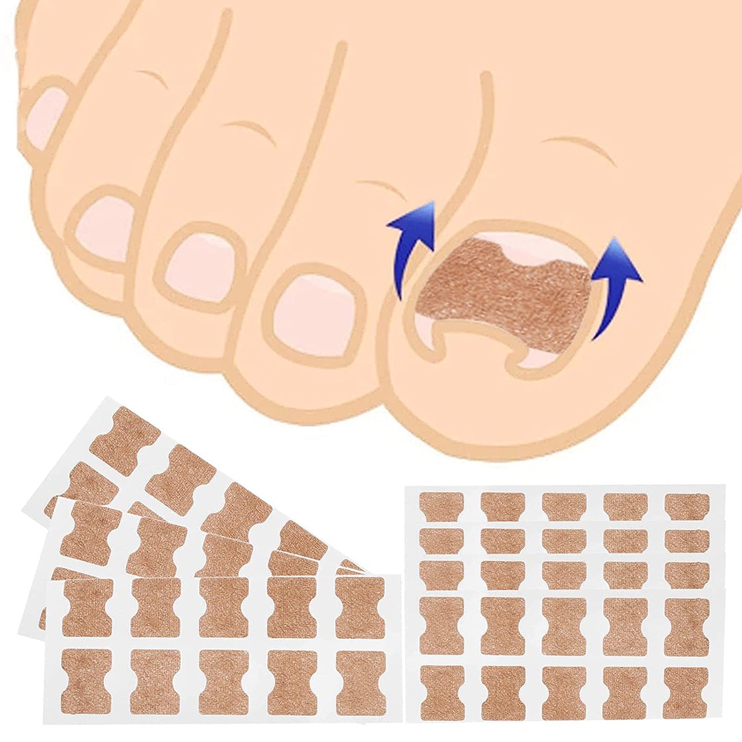 Nail Groove Embedded Nail Corrector Set Of Tools