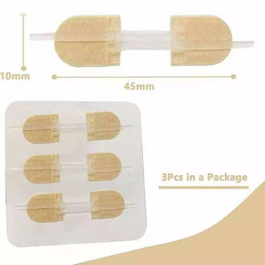 Non-woven Zipper Skin Stapler Wound Suture Patch Pull Self-adhesive Bandage