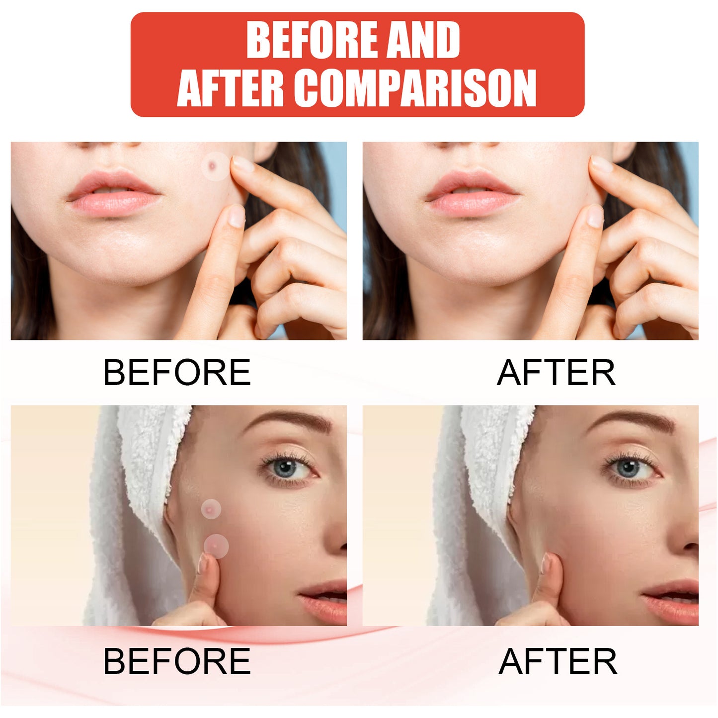 Invisible Breathable Repair Hydrogel Acne Patch