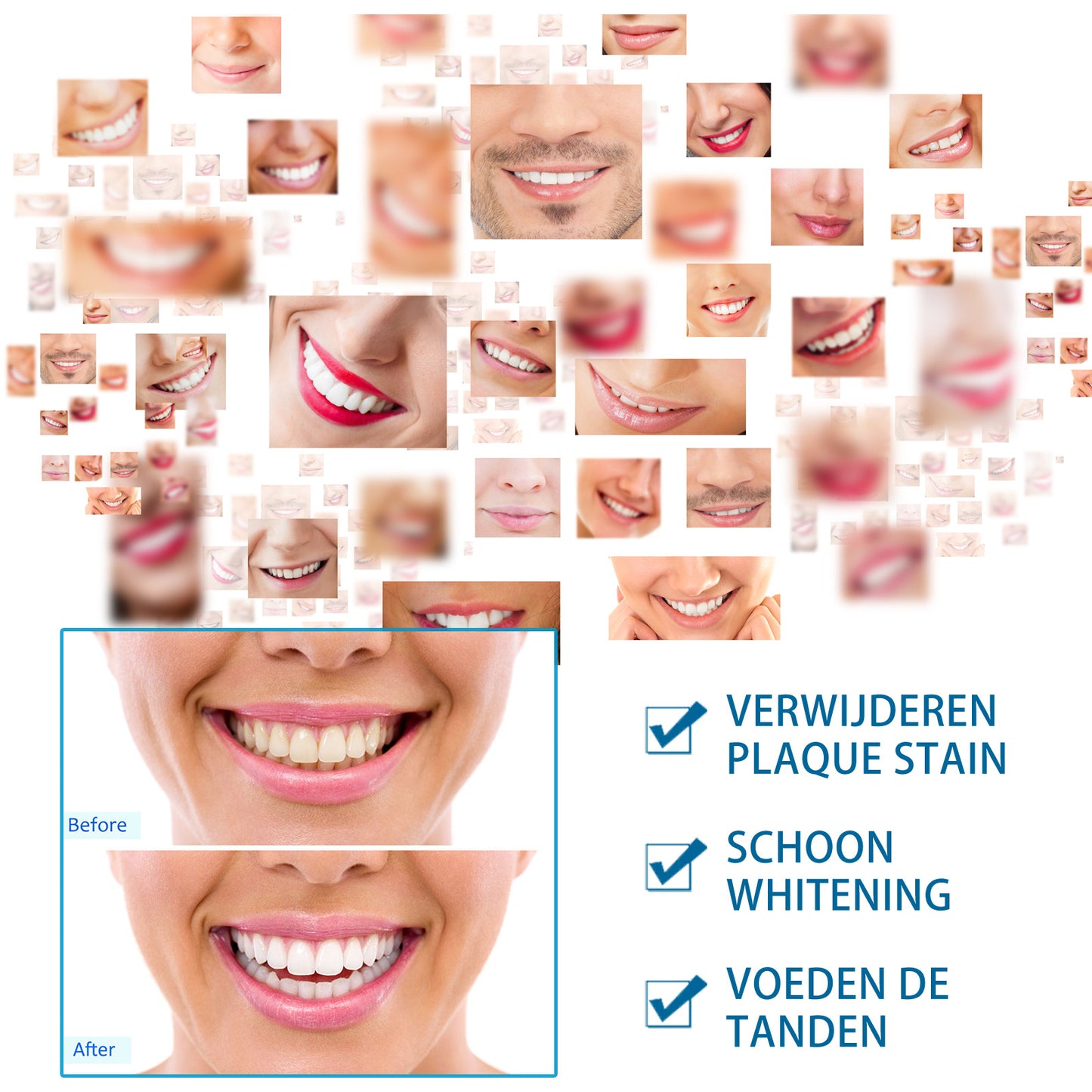 Teeth White Pen Oral Cleaning Beautiful Tooth Brightening