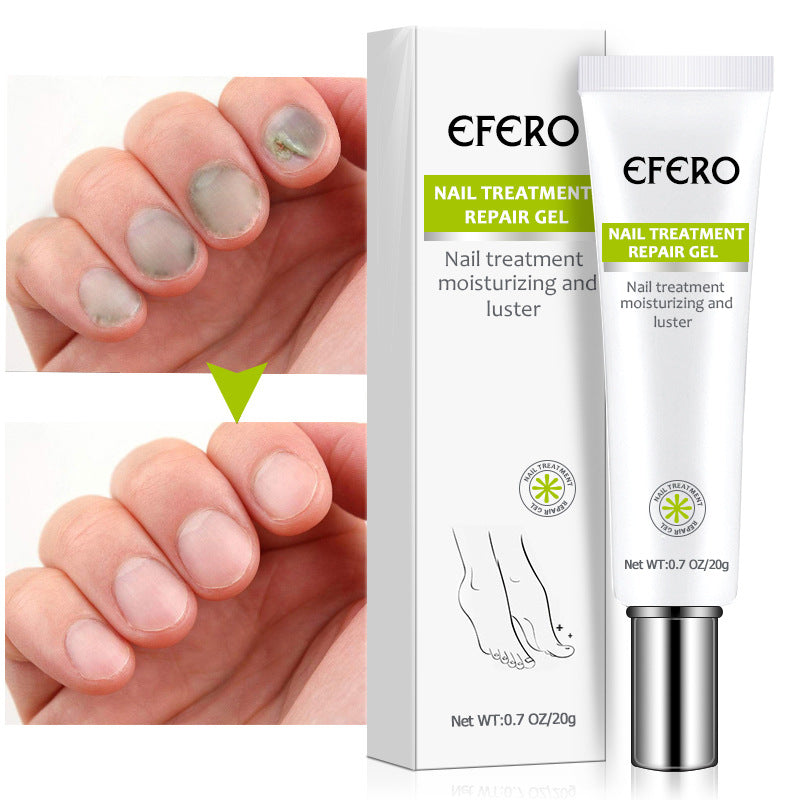 Nail Gel Nail Liquid Plant Nail Liquid